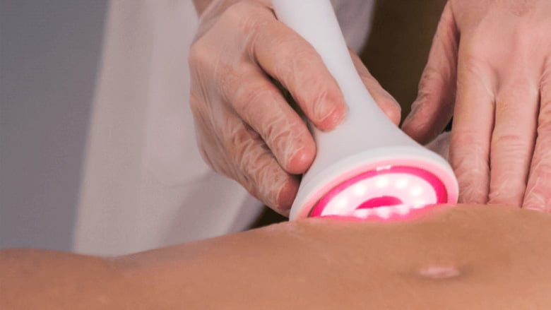 Mesoterapia virtual mesolux
