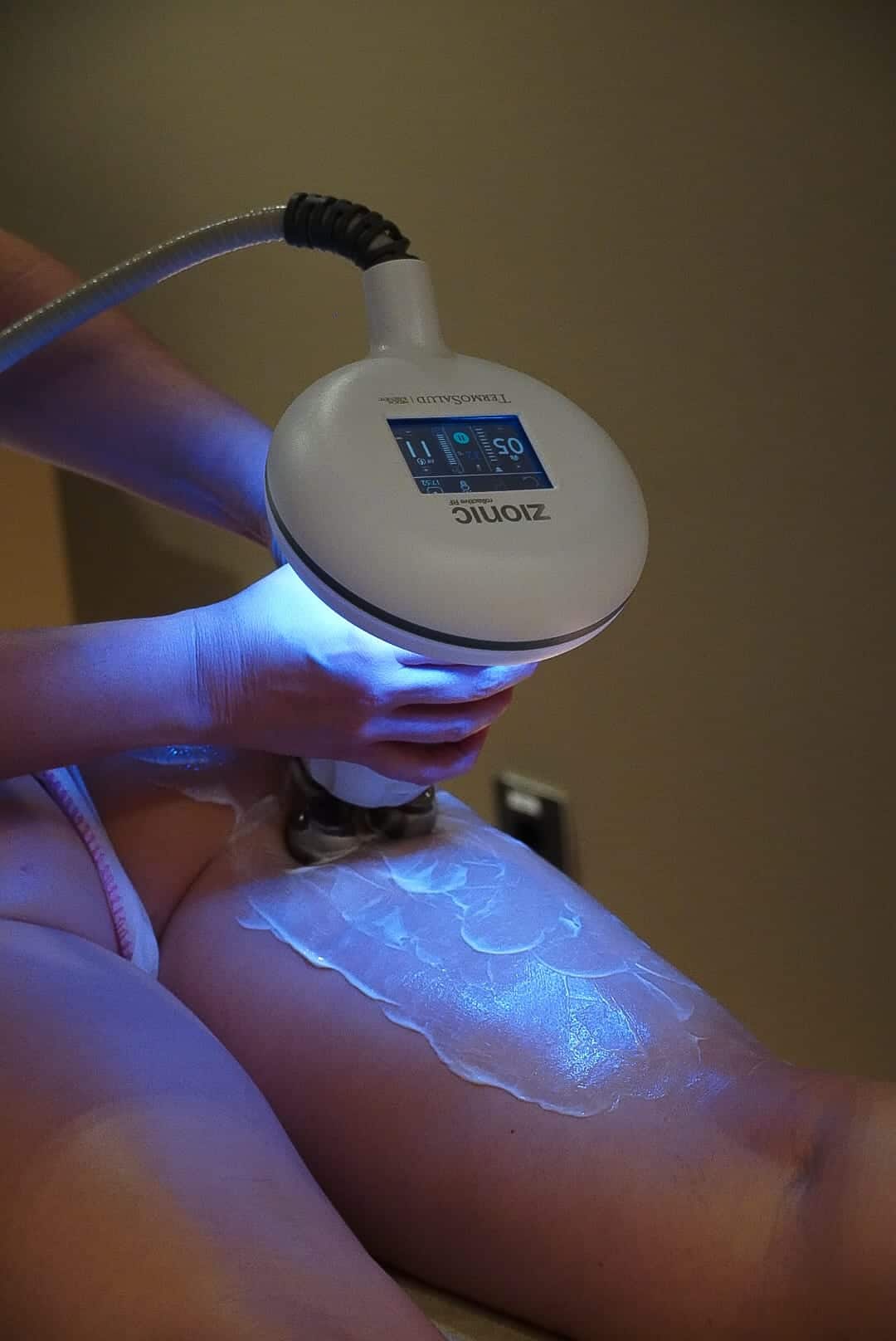 Tratamiento corporal estético en Madrid con dispositivo avanzado Zionic para celulitis, flacidez y grasa localizada