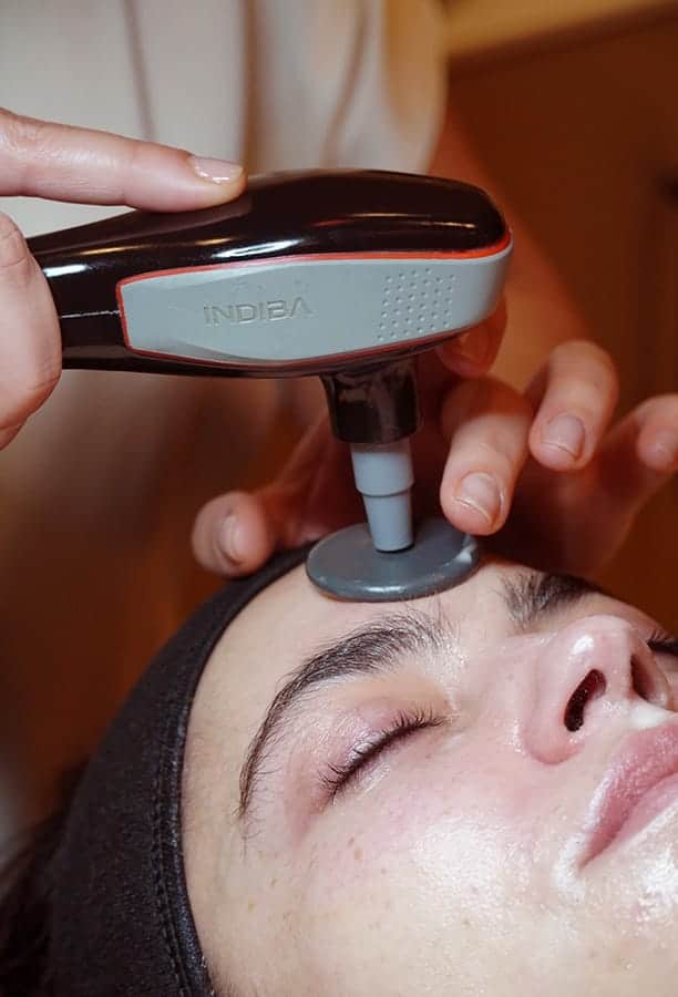 Tratamiento facial con dispositivo Indiba Facial Pro Max en Madrid